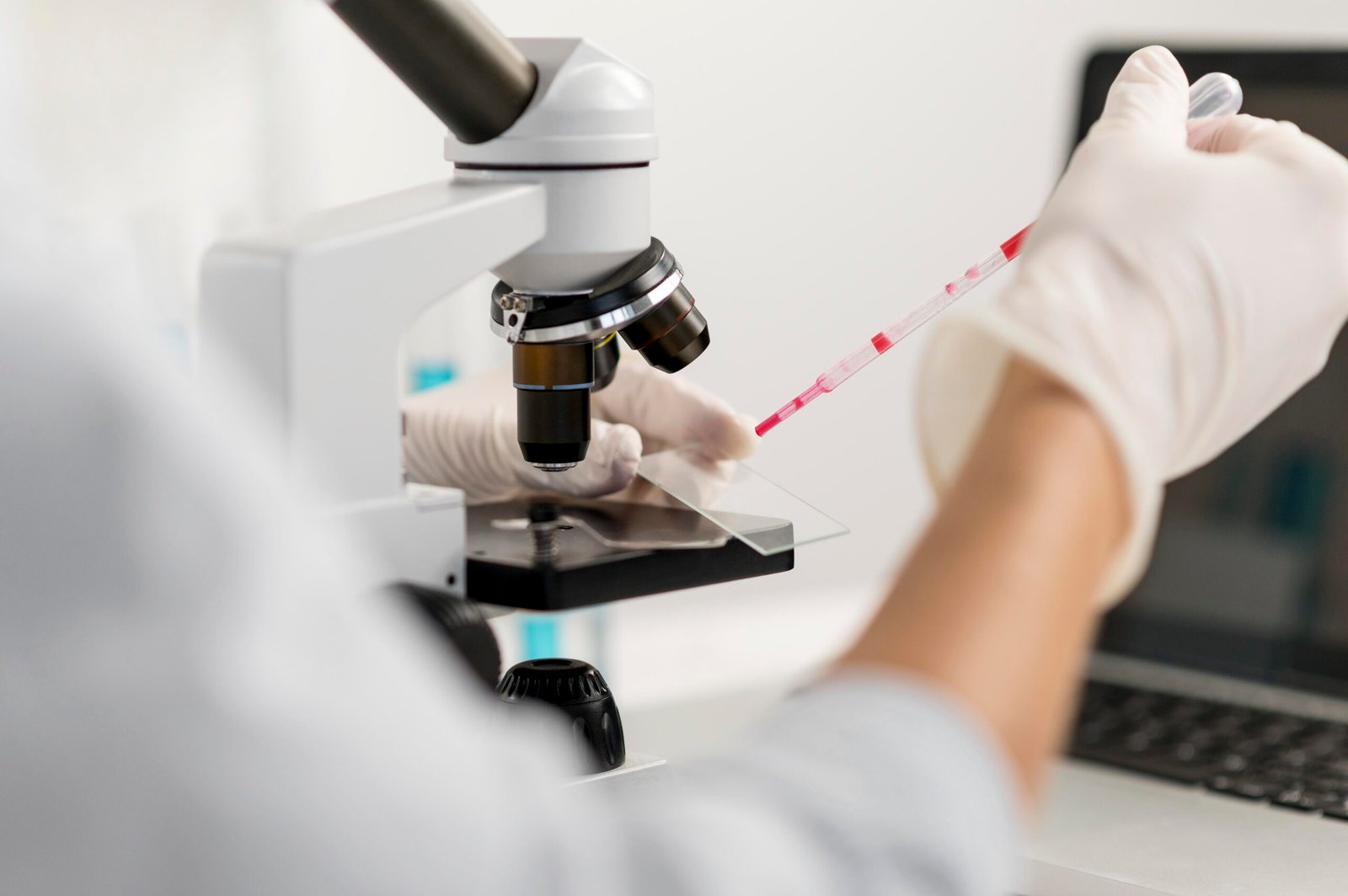 Biopsia por VPH: Guía completa sobre el estudio, resultados y cuidados